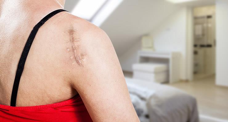 Advancements in Scar Therapy with Dr. S. Manjula Jegasothy